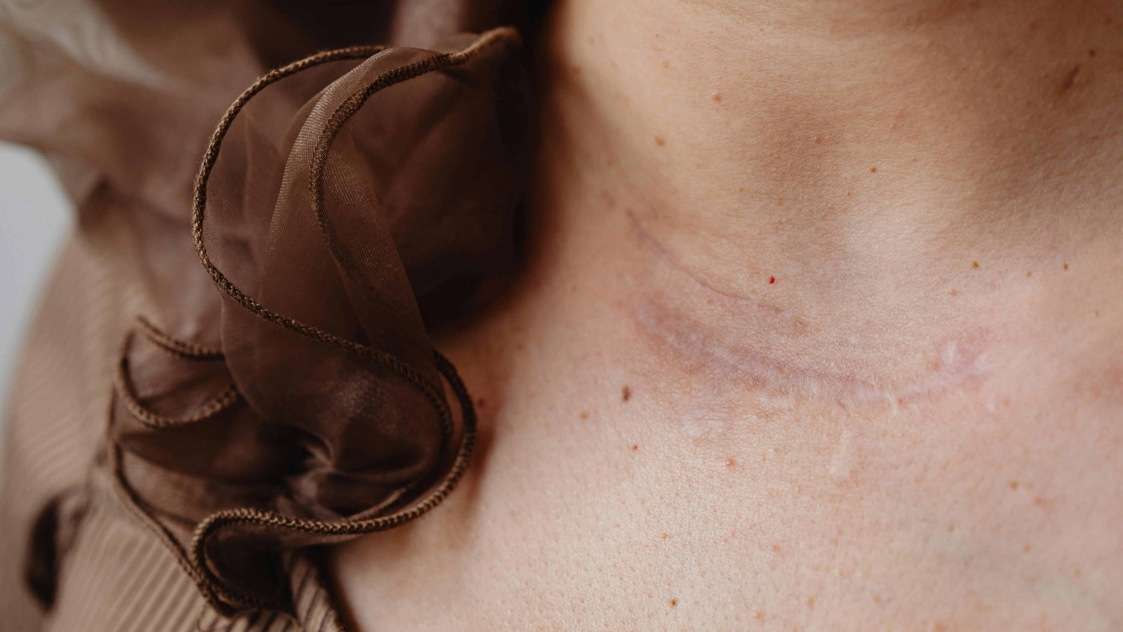15 Ways Barometric Pressure Changes Affect Your Body 9